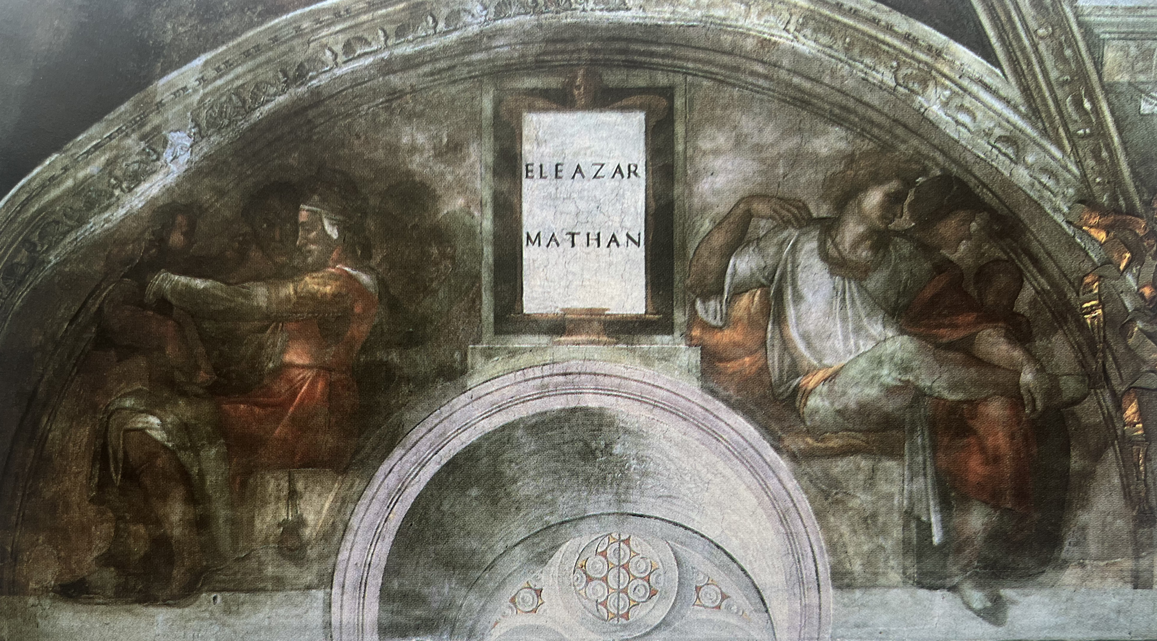 Figure 3: (OT5_2) Lunette before cleaning